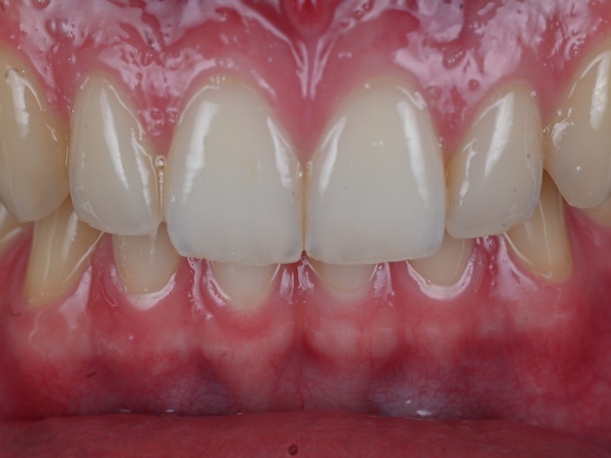 Photographie clinique des dents et des gencives