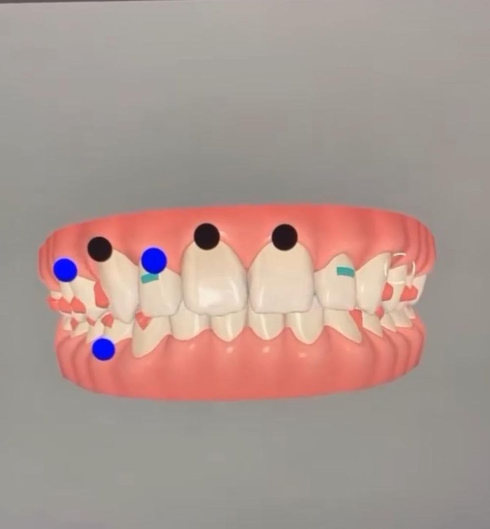 Planification numérique 3D d’un traitement